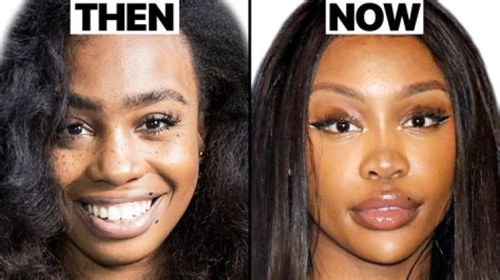Kim Bella Before and After Plastic Surgery: A Comprehensive Analysis