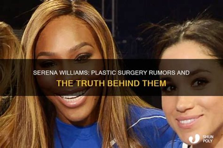 Serena Williams: The Truth Behind Plastic Surgery Rumors